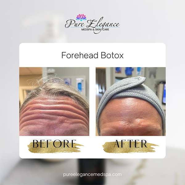 Pure Elegance MedSpa   Skin Care | Diamond Glow Facial, BOTOX reg  and B12 Injections