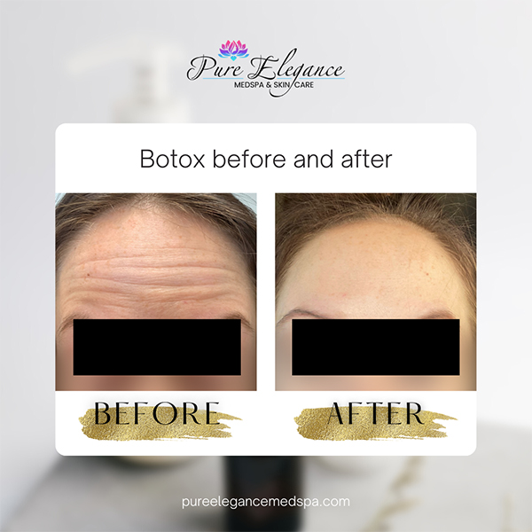 Pure Elegance MedSpa   Skin Care | Dermaplaning, B12 Injections and Diamond Glow Facial