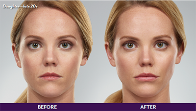 Pure Elegance MedSpa   Skin Care | Dermal Fillers, Microneedling and BOTOX reg