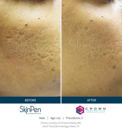 Pure Elegance MedSpa   Skin Care | Facials, Waxing and Dermaplaning